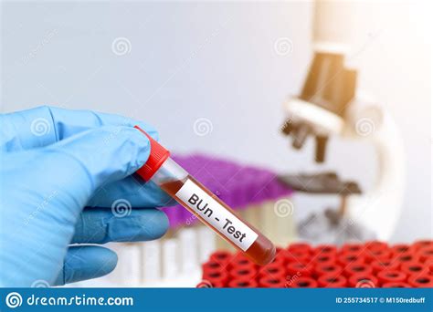 an adult patients blood sample is analyzed in a laboratory|patient education in blood testing.